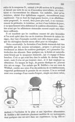 Fig. 475 à Fig. 477 - Traité de médecine opératoire, bandages et appareils. 4è éd. Tome premier