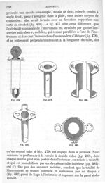 Fig. 478 à Fig. 482 - Traité de médecine opératoire, bandages et appareils. 4è éd. Tome premier