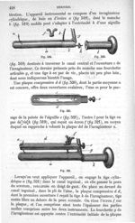 Fig. 518 à Fig. 521 - Traité de médecine opératoire, bandages et appareils. 4è éd. Tome premier