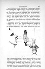 Fig. 542 - Traité de médecine opératoire, bandages et appareils. 4è éd. Tome premier