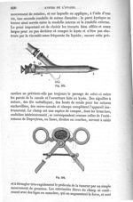 Fig. 575., Fig. 576 - Traité de médecine opératoire, bandages et appareils. 4è éd. Tome premier