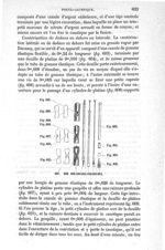 Fig. 603 à Fig.  Fig. 621 - Traité de médecine opératoire, bandages et appareils. 4è éd. Tome premie [...]