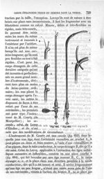 Fig. 693., Fig. 694 - Traité de médecine opératoire, bandages et appareils. 4è éd. Tome premier