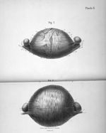 Fig. 1 et 2 - Recherches sur la disposition des fibres musculaires de l'utérus développé par la gros [...]