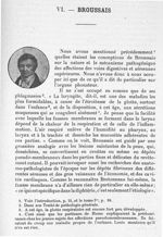 Broussais - Les maîtres de l'Ecole de Paris dans la période préspécialistique des maladies du pharyn [...]