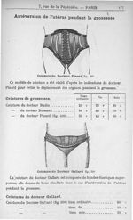 Antéversion de l'utérus pendant la grossesse. Ceinture du Docteur Pinard - Instruments et appareils  [...]