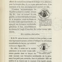 0103 - Page 99 - Dix-septième observation / Dix-huitième observation
