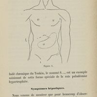 0061 - Page 53 - Symptômes hépatiques