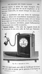 Fig. 121. Spiromètre de Verdin - Guide pratique pour l'examen des maladies du larynx, du nez et des  [...]