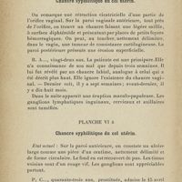 0310 - Page 288 - Planche VI a et b. Chancre syphilitique du col utérin