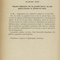 0424 - Page 344 - Planche XXXV. Papules végétantes sur les grandes lèvres, les plis génito-cruraux, le périnée et l'anus