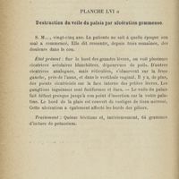 0512 - Page 390 - Planche LVI a. Destruction du voile du palais par ulcération gommeuse