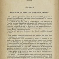 0280 - Page 260 - Iconographie. Planche I. Hyperidrose des pieds, avec formation de vésicules