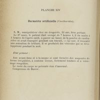 0330 - Page 284 - Planche XIV. Dermatite artificielle (Cantharides)