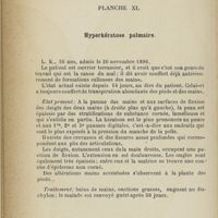 0432 - Page 334 - Planche XL. Hyperkératose palmaire