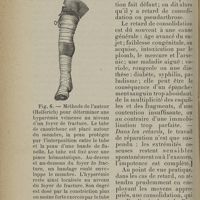 0070 - Page 48 - 10. Pseudarthrose