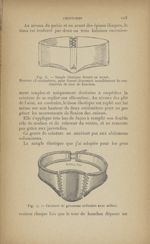 Fig. 6. - Sangle élastique fermée en avant / Fig. 7. - Ceinture de grossesse ordinaire avec œillets  [...]