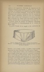 Fig. 8. - Sangle élastique genre "ceinture de grossesse" - Abdominales méconnues. Les déséquilibrées [...]