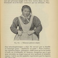 0433 - Page 399 - B. - Hébéphrénie