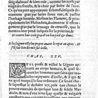 0323 - Page 295 - Si la saignee est plus propre auant le repas ou apres. Et s'il fait bon dormir sur icelle. Chap. XXV