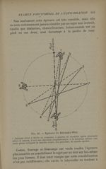 Fig. 25. - Epreuve de Babinski-Weil - Otites et surdités de guerre : diagnostic, traitement, experti [...]