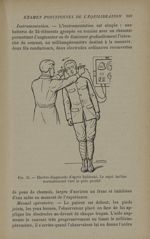 Fig. 31. - Electro-diagnostic d'après Babinski. Les sujet incline normalement vers le pôle positif - [...]