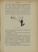 Fig. 55 (ter). - Babinski - Curiosa de médecine littéraire - anecdotique - artistique