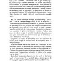 0610 - Page 586 - Revue des travaux français et étrangers. Thérapeutique chirurgicale. Une opération délicate couronnée de succès (Soc. Méd. d'Ottawa). / Un cas curieux de corps étranger dans l'oesophage. Extraction à l'aide de l'oesophagoscope (Journ. de méd. de Bordeaux)