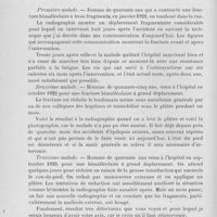 0176 - Page 156 - Séance du 30 janvier. Présentations de malades. Fractures bimalléolaires, par M. P. Alglave