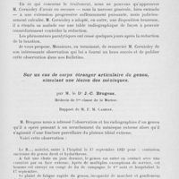 0507 - Page 487 - Séance du 2 avril 1924. Rapports. Luxation de la colonne cervicale. Paralysie radiculaire. Guérison après réduction, par M. Charles Cornioley / Sur un cas de corps étranger articulaire du genou, simulant une lésion des ménisques, par M. le Dr J. -C. Brugeas