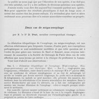 0539 - Page 519 - Séance du 2 avril 1924. Communications. Les résultats anatomiques de 102 staphylorraphies, par M. Victor Veau / Deux cas de méga-oesophage, par M. le Dr D. Prat