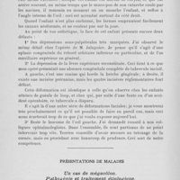 0612 - Page 592 - Séance du 7 mai 1924. Communications. Restauration terminée d’une tissure faciale fronto-maxillaire bilatérale, par M. L. Ombrédanne / Présentations de malades. Un cas de mégacôlon. Pathogénie et traitement étiologique, par M. Georges Lardennois