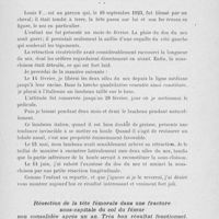 0823 - Page 803 - Séance du 25 juin 1924. Présentations de malades. Deux autoplasties nasales, par M. L. Ombrédanne / Résection de la tête fémorale dans une fracture sous-capitale du col du fémur non consolidée après un an. Très bon résultat fonctionnel, par M. Alglave