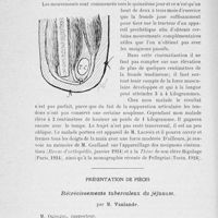 0862 - Page 842 - Séance du 2 juillet 1924. Présentations de malades. Cinématisation d’un moignon d’amputation de l’avant-bras par le procédé de Pellegrini, par M. Mauclaire / Présentation de pièces. Rétrécissements tuberculeux du jéjunum, par M. Vanlande