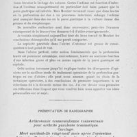 0937 - Page 917 - Séance du 15 octobre 1924. Deuxième séance. Communications. A propos du traitement opératoire des ulcères gastro-duodénaux perforés; indications fournies par l'étude anatomique et pathogénique de la perforation, par. M. Pierre Duval / Présentation de radiographie. Arthrotomie transrotulienne transversale pour arthrite purulente traumatique. Cerclage. Mort accidentelle vingt-neuf mois après l’opération. Autopsie. Présentation de la radiographie de la rotule, par M. Gabriel Miginiac