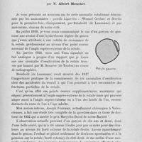 1023 - Page 1003 - Séance du 5 novembre 1924. Présentation de radiographie. Anomalie rotulienne. « Patella bipartita », par M. Albert Mouchet