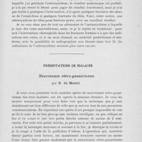 1139 - Page 1119 - Séance du 3 décembre 1924. Question à l’ordre du jour. Sur l’ostéosynthèse, par M. Anselme Schwartz / Présentations de malades. Neurotomie rétro-gassérienne, par M. de Martel