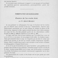 1141 - Page 1121 - Séance du 3 décembre 1924. Présentations de malades. Nécrose aiguë massive du fémur (suivie de fracture spontanée) consécutive à une injection septique d’azote dans la cuisse, par M. E. Duguet / Présentation de radiographie. Fracture de l’os crochu droit, par M. Albert Mouchet