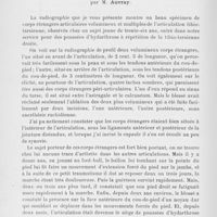 1324 - Page 1280 - Séance du 21 novembre 1928. Présentation de pièce. Corps étrangers articulaires du cou-de-pied, par M. Auvray