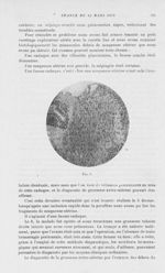 Fig. 1. [Un moyen de diagnostic de la grossesse extra-utérine]  - Bulletins et mémoires de la sociét [...]