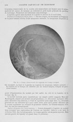 Fig. 2. — Coupe transversale du segment de trompe réséqué. On reconnaît en haut et à gauche un segme [...]