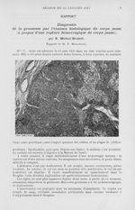 [Diagnostic de la grossesse par l’examen histologique du corps jaune (à propos d’une rupture hémorra [...]