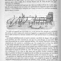 0212 - Page 204 - Gouttière à valves mobiles. Par le docteur Nicaise. Construite par M. Aubry, à Paris / Académies et sociétés savantes. Société de chirurgie. Séance du 1er février