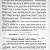 0343 - Page 335 - Le stypage / Hôpital Bichat. - Service de M. le Dr F. Terrier. Kyste multiloculaire de l'ovaire droit. - Ovariotomie. - Ictère fébrile. Congestion pulmonaire à droite. - Guérison. (Observation rédigée sur les notes de M. Montprofit...)