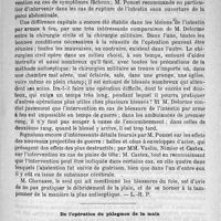 0415 - Page 407 - Bulletin / De l'opération du phlegmon de la main. Par Ant. Courtade...