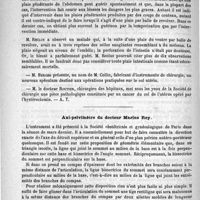 0670 - Page 654 - Académies et sociétés savantes. Société de chirurgie. Séance du 18 avril / Axi-pelvimètre du docteur Maris Rey