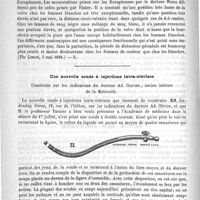 0182 - Page 178 - Revue des journaux. Position de la vulve chez les femmes de couleur (The Lancet, 5 mai 1888) / Une nouvelle sonde à injections intra-utérines construite sur les indications du Docteur Ad. Olivier...