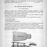 0730 - Page 726 - Thérapeutique. De l'aliment le mieux approprié au traitement de la convalescence, à la suite des maladies infectieuses graves, telles que la fièvre typhoïde, etc... [Dr Is. David] / Des appareils plâtrés instantanés, par le Docteur Vernoy