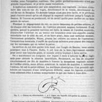 0870 - Page 854 - De l'hystéropexie vaginale. Par L.-G. Richelot