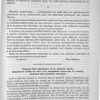 0933 - Page 917 - Traitement des maladies chroniques de la moelle (A suivre) [Paul Chéron] / Tumeurs fibro-plastiques de la mamelle droite. Amputation totale du sein avec anesthésie locale par la cocaïne. Guérison par première intention